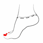 Anklets